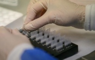 DSÖ, gizemli hepatit virüsünden 1 çocuğun hayatını kaybettiğini bildirdi