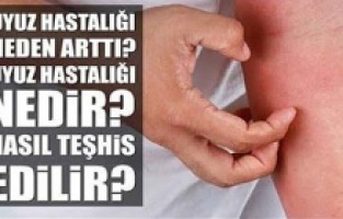 Uyuzun belirtileri nelerdir, hangi bölgelerde görülür?