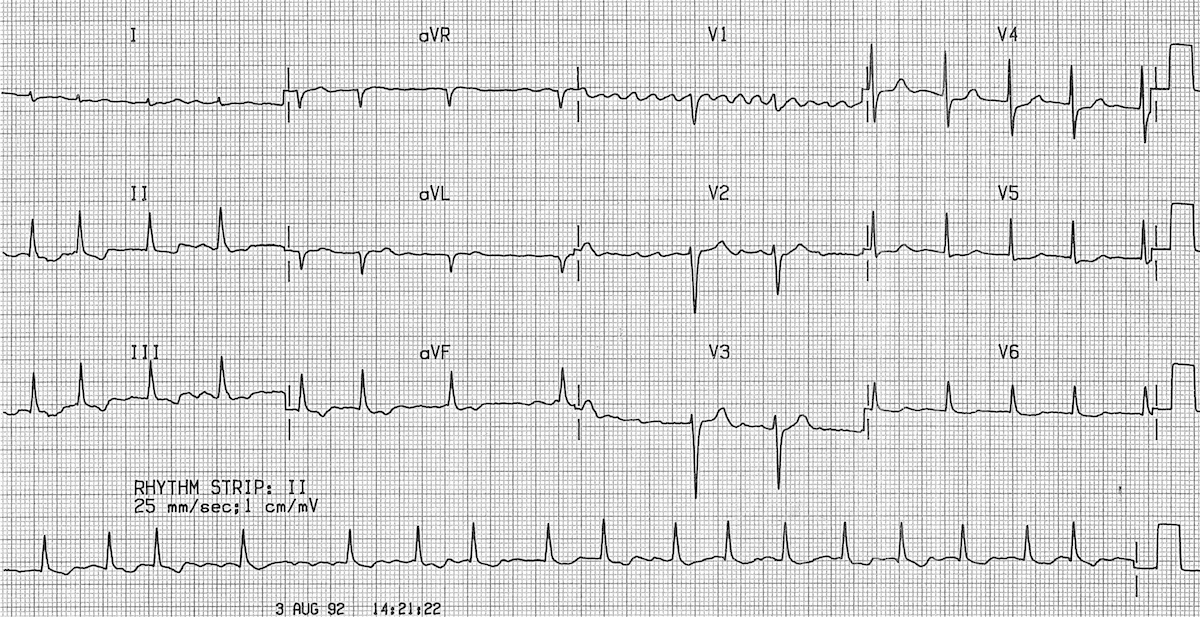 Kalbimiz, yaşam boyu hiç durmadan çalışan bir motor gibidir. Dakikada