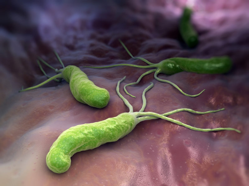 Dünya nüfusunun yaklaşık yarısının taşıdığı düşünülen Helicobacter pylori, ülserden gastrite